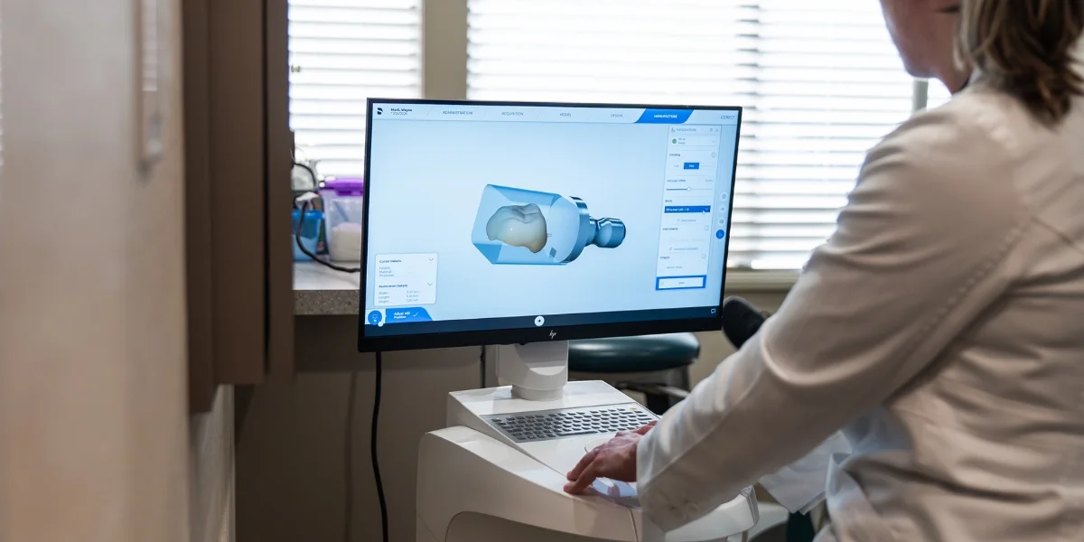 A dental implant model showing the structure of implant dentistry